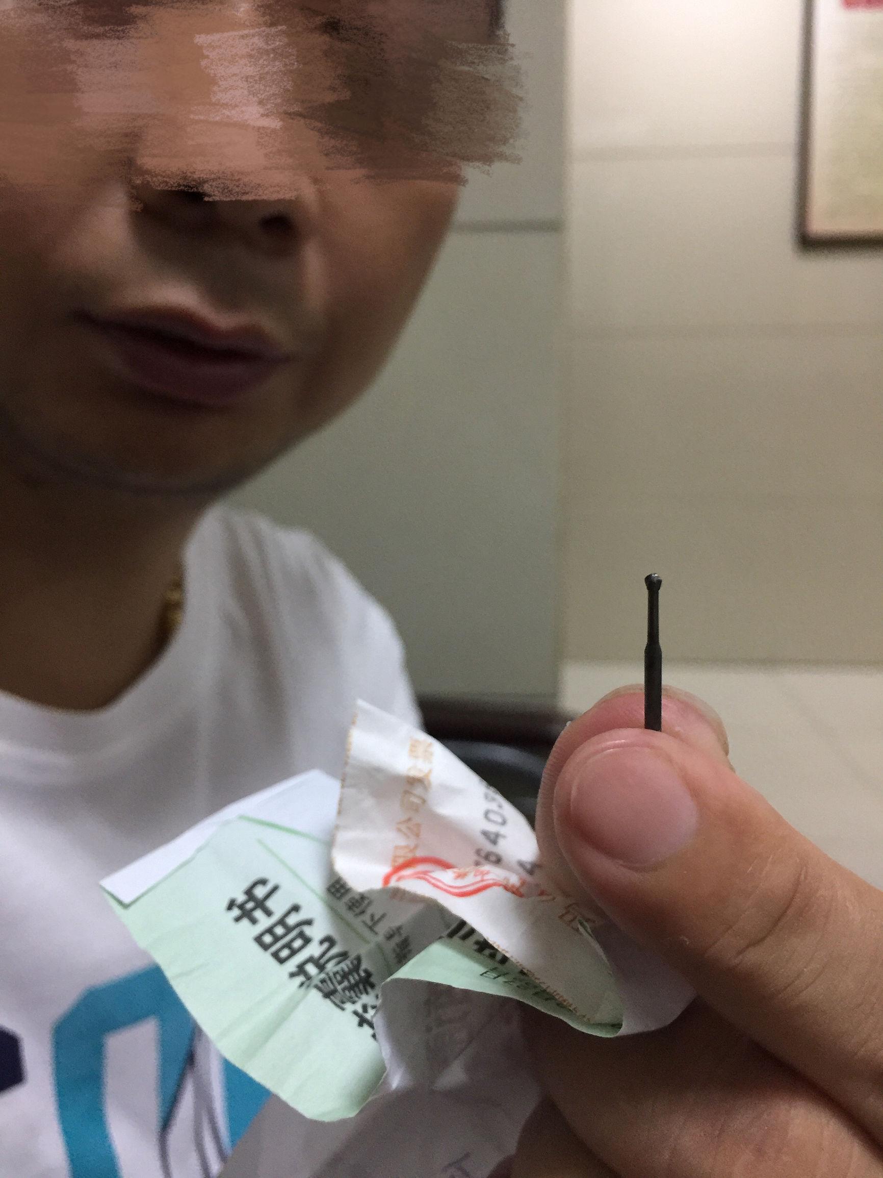 男子补牙遭遇惊魂时刻，种植钻头意外掉落口中，引发社会关注与热议